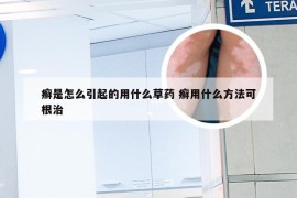 癣是怎么引起的用什么草药 癣用什么方法可根治