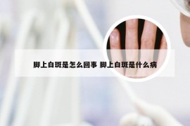 脚上白斑是怎么回事 脚上白斑是什么病