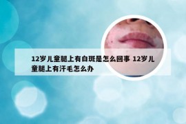 12岁儿童腿上有白斑是怎么回事 12岁儿童腿上有汗毛怎么办