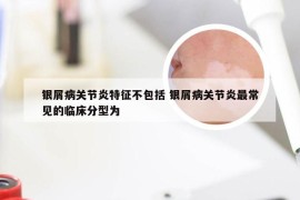 银屑病关节炎特征不包括 银屑病关节炎最常见的临床分型为