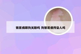 银屑病跟狗关联吗 狗银屑病传染人吗