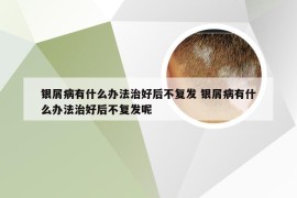 银屑病有什么办法治好后不复发 银屑病有什么办法治好后不复发呢