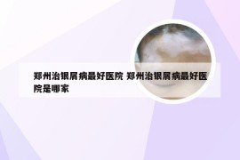 郑州治银屑病最好医院 郑州治银屑病最好医院是哪家