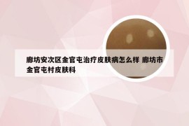 廊坊安次区金官屯治疗皮肤病怎么样 廊坊市金官屯村皮肤科