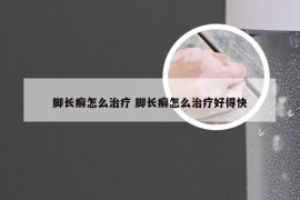 脚长癣怎么治疗 脚长癣怎么治疗好得快