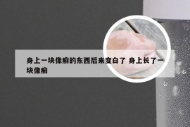 身上一块像癣的东西后来变白了 身上长了一块像癣