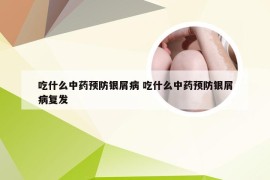 吃什么中药预防银屑病 吃什么中药预防银屑病复发