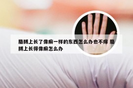 胳膊上长了像癣一样的东西怎么办也不痒 胳膊上长得像癣怎么办