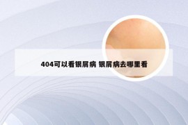 404可以看银屑病 银屑病去哪里看