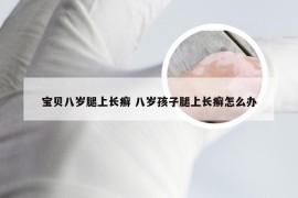 宝贝八岁腿上长癣 八岁孩子腿上长癣怎么办