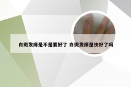 白斑发痒是不是要好了 白斑发痒是快好了吗