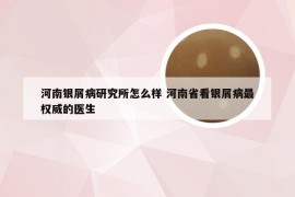 河南银屑病研究所怎么样 河南省看银屑病最权威的医生