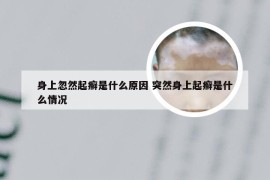 身上忽然起癣是什么原因 突然身上起癣是什么情况