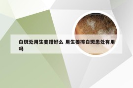 白斑处用生姜蹭好么 用生姜擦白斑患处有用吗