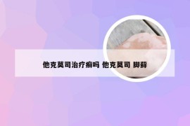 他克莫司治疗癣吗 他克莫司 脚藓