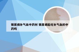 银屑病补气血中药材 银屑病能吃补气血的中药吗