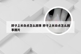 脖子上长白点怎么回事 脖子上长白点怎么回事图片