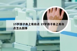 15岁孩子身上有白点 15岁孩子身上有白点怎么回事