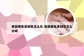 局部黑色素缺失怎么办 局部黑色素缺失怎么办呢