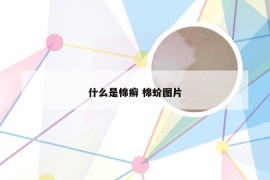 什么是棉癣 棉蚧图片