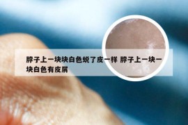 脖子上一块块白色蜕了皮一样 脖子上一块一块白色有皮屑