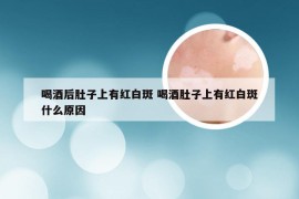 喝酒后肚子上有红白斑 喝酒肚子上有红白斑什么原因