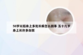 50岁以后身上多处长癣怎么回事 五十几岁身上长许多白斑