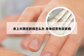 身上长期皮肤病怎么办 身体经常有皮肤病