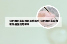 郑州国内最好的银屑病医院 郑州国内最好的银屑病医院是哪家