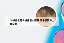 58岁身上起白点是怎么回事 五十多岁身上有白点