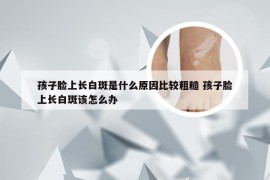 孩子脸上长白斑是什么原因比较粗糙 孩子脸上长白斑该怎么办