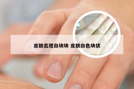 皮肤出现白块块 皮肤白色块状