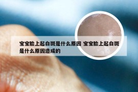 宝宝脸上起白斑是什么原因 宝宝脸上起白斑是什么原因造成的