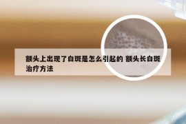 额头上出现了白斑是怎么引起的 额头长白斑治疗方法