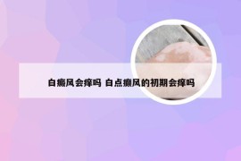 白癜风会痒吗 白点癫风的初期会痒吗