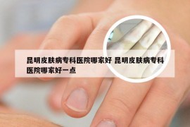 昆明皮肤病专科医院哪家好 昆明皮肤病专科医院哪家好一点