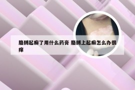 胳膊起癣了用什么药膏 胳膊上起癣怎么办很痒