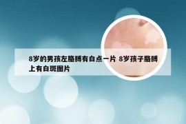 8岁的男孩左胳膊有白点一片 8岁孩子胳膊上有白斑图片