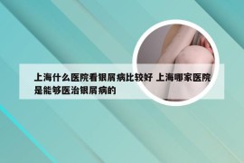 上海什么医院看银屑病比较好 上海哪家医院是能够医治银屑病的