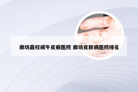 廊坊最权威牛皮癣医院 廊坊皮肤病医院排名