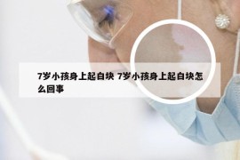 7岁小孩身上起白块 7岁小孩身上起白块怎么回事