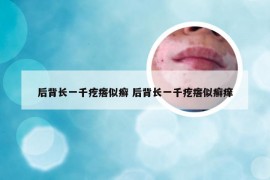 后背长一千疙瘩似癣 后背长一千疙瘩似癣痒