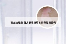 苗方肤毒康 苗方肤毒康草本乳膏能用脸吗