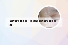 点阵激光多少钱一次 剥脱点阵激光多少钱一次