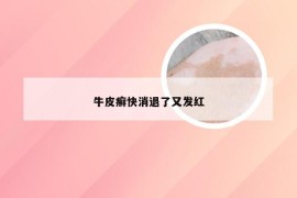 牛皮癣快消退了又发红