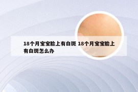 18个月宝宝脸上有白斑 18个月宝宝脸上有白斑怎么办