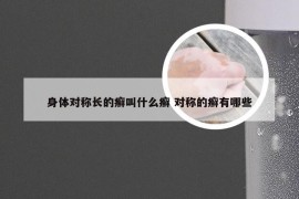 身体对称长的癣叫什么癣 对称的癣有哪些