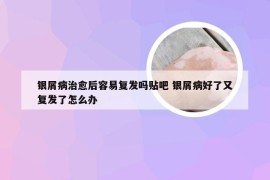 银屑病治愈后容易复发吗贴吧 银屑病好了又复发了怎么办