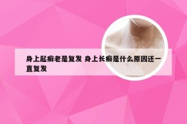 身上起癣老是复发 身上长癣是什么原因还一直复发