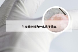 牛皮癣吃辣为什么鼻子流血